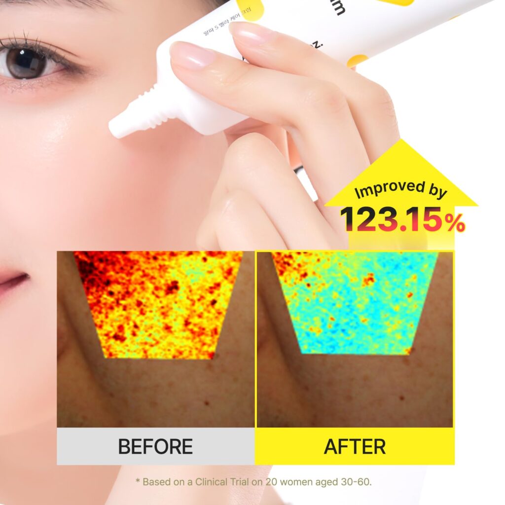 Tiam - Alpha-5 Mela Cream – Crema Despigmentante 50 ml