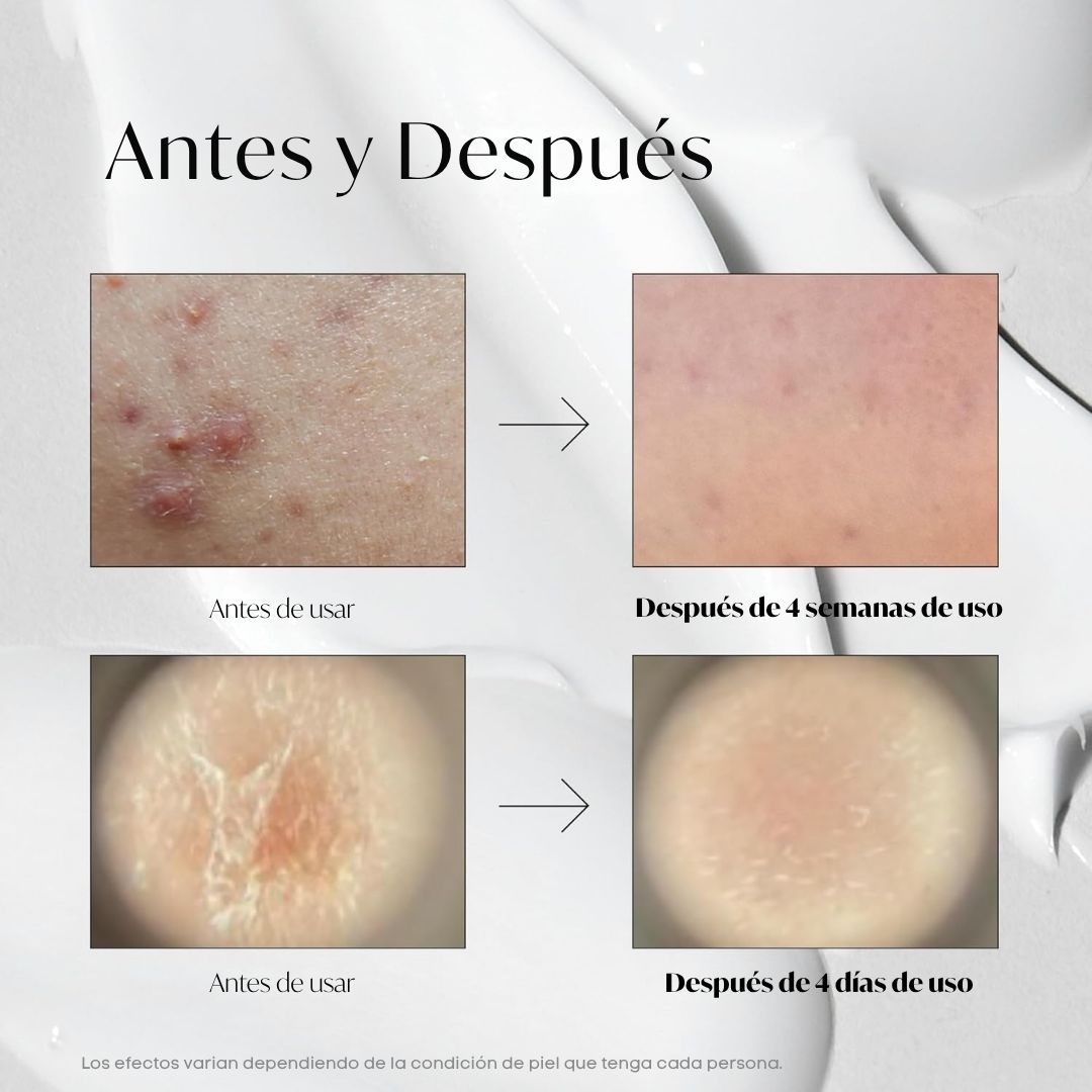 VT Cosmetics - VT Reedle Shot 100