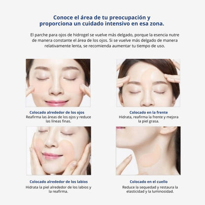 Snp parches - Bird’s Nest Eye Patch